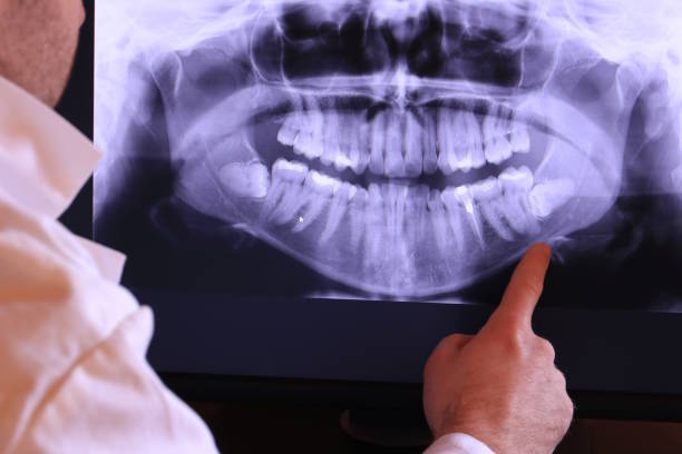 Best Emergency Dental Care for Abscessed Tooth in Lake Caroline, VA